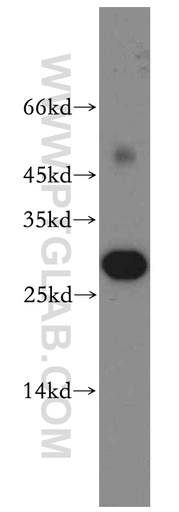[13052-1-AP-150UL] ASPRV1 Polyclonal antibody