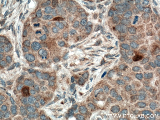 [13054-1-AP-150UL] THRSP Polyclonal antibody