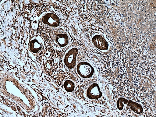 [13059-1-AP-150UL] CALML5 Polyclonal antibody