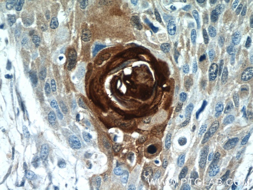 [13061-1-AP-150UL] S100A7/Psoriasin Polyclonal antibody