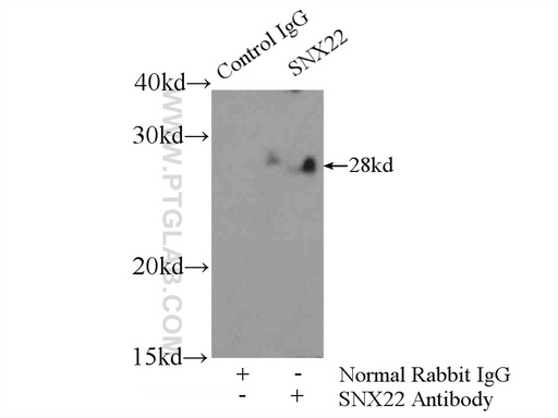 [13062-1-AP-150UL] SNX22 Polyclonal antibody