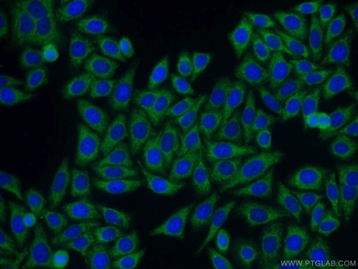 [13063-1-AP-150UL] SAMSN1 Polyclonal antibody