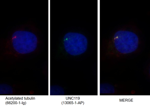 [13065-1-AP-20UL] UNC119 Polyclonal antibody