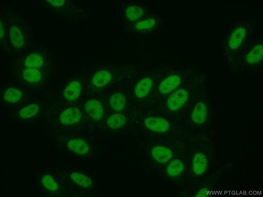 [13066-1-AP-20UL] SMARCA5 Polyclonal antibody