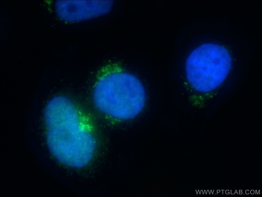 [13068-1-AP-150UL] MCFD2 Polyclonal antibody