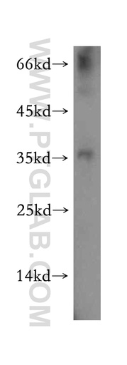 [13069-1-AP-150UL] NKX3-1 Polyclonal antibody