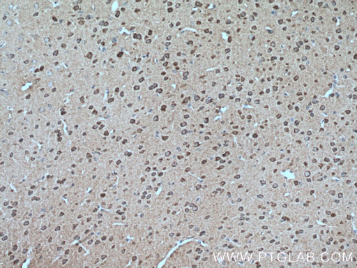 [13075-1-AP-150UL] DFNA5/GSDME Polyclonal antibody