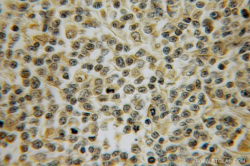 [13079-1-AP-20UL] PTPRA Polyclonal antibody