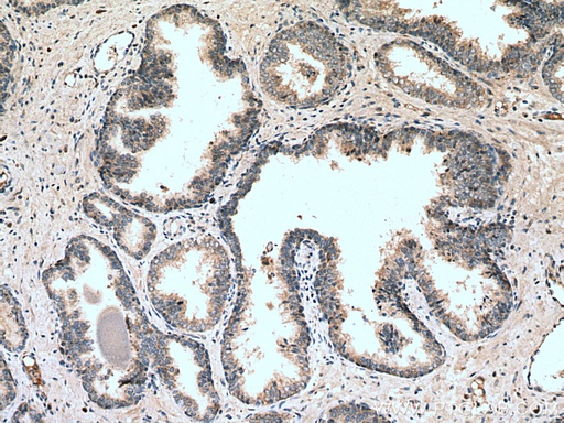 [13080-1-AP-150UL] SLC25A32 Polyclonal antibody