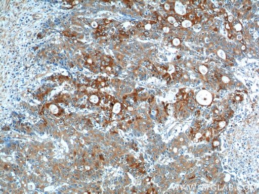 [13082-1-AP-150UL] IL-17 Polyclonal antibody