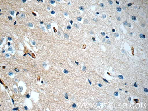 [13084-1-AP-20UL] PEX5L Polyclonal antibody