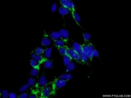[13085-1-AP-150UL] CTNS Polyclonal antibody
