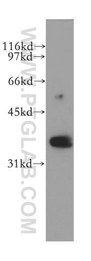 [13088-1-AP-150UL] RHOXF2 Polyclonal antibody