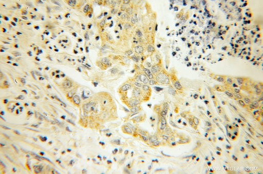 [13089-1-AP-20UL] TRX2 Polyclonal antibody
