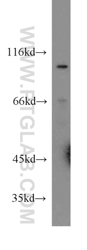 [13091-1-AP-20UL] Cadherin-18 Polyclonal antibody