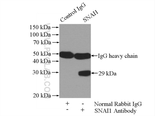 [13099-1-AP-150UL] SNAI1 Polyclonal antibody