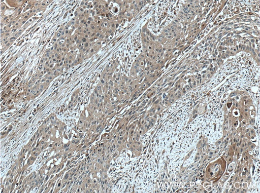 [13102-2-AP-20UL] SERPINB8 Polyclonal antibody