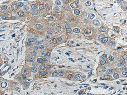 [13105-1-AP-20UL] KIF2A Polyclonal antibody