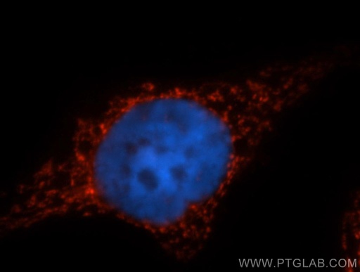 [13108-1-AP-20UL] PYCR1 Polyclonal antibody