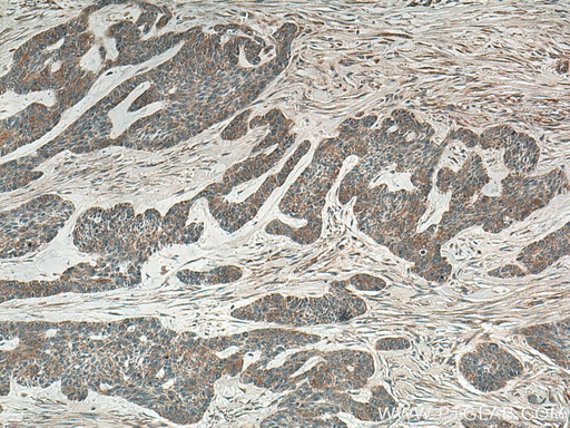 [13113-1-AP-20UL] IL-36RN Polyclonal antibody
