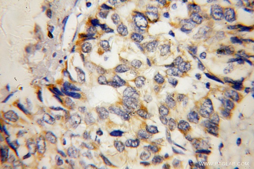 [13114-1-AP-20UL] MTHFS Polyclonal antibody