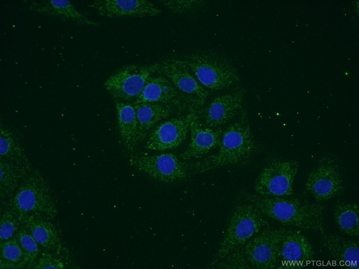 [13115-1-AP-150UL] VAMP1 Polyclonal antibody
