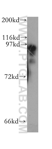 [13117-2-AP-150UL] PKD2L1 Polyclonal antibody