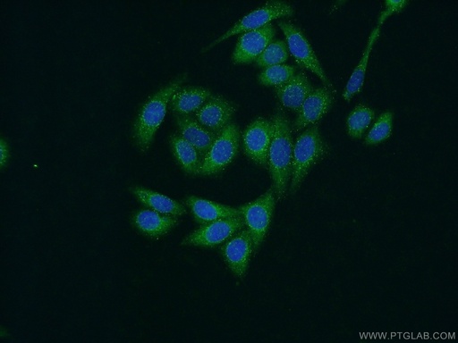 [13118-2-AP-20UL] ZFYVE16 Polyclonal antibody