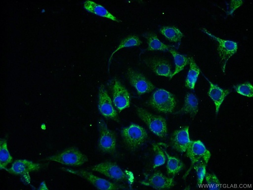 [13123-1-AP-150UL] PPP2R2B/A/C/D Polyclonal antibody