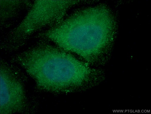 [13126-1-AP-150UL] USP24 Polyclonal antibody
