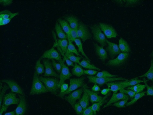 [13129-1-AP-20UL] TrkB Polyclonal antibody