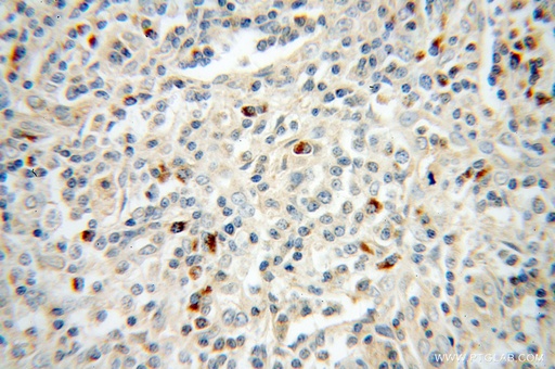 [13132-1-AP-20UL] TRAV20 Polyclonal antibody