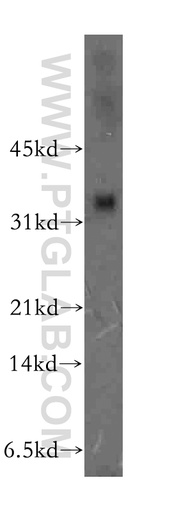[13133-1-AP-150UL] ULBP2 Polyclonal antibody