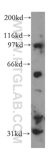 [13135-1-AP-150UL] CHST9 Polyclonal antibody