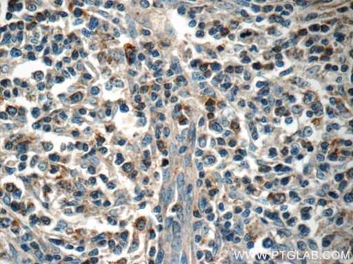 [13137-1-AP-20UL] MINK1 Polyclonal antibody