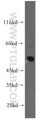 [13145-1-AP-150UL] GLRA3 Polyclonal antibody
