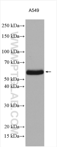 [13148-1-AP-150UL] ZC3HC1 Polyclonal antibody