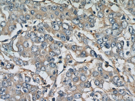 [13149-1-AP-150UL] FBXW11 Polyclonal antibody