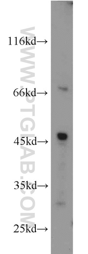 [13150-1-AP-150UL] GYG2 Polyclonal antibody