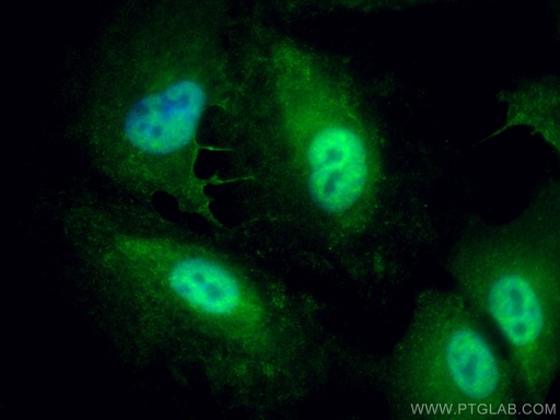 [13151-1-AP-150UL] UGDH Polyclonal antibody