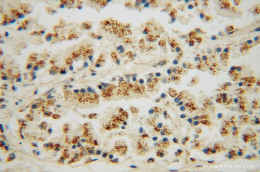 [13159-1-AP-150UL] DHX36 Polyclonal antibody