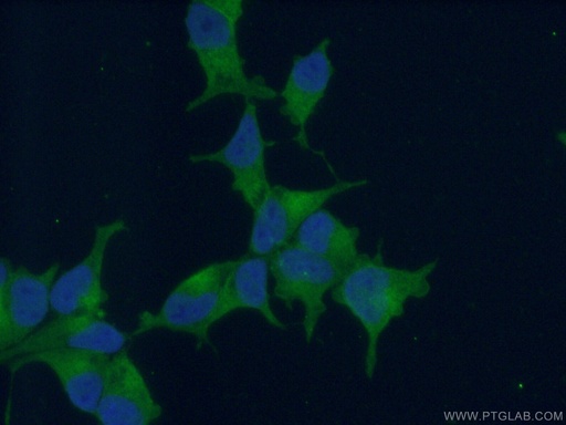 [13163-1-AP-150UL] PSMA/GCPII Polyclonal antibody