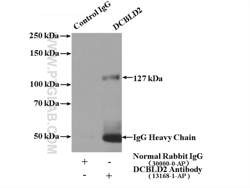 [13168-1-AP-150UL] DCBLD2 Polyclonal antibody
