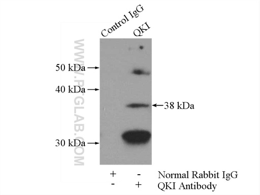 [13169-1-AP-20UL] QKI Polyclonal antibody