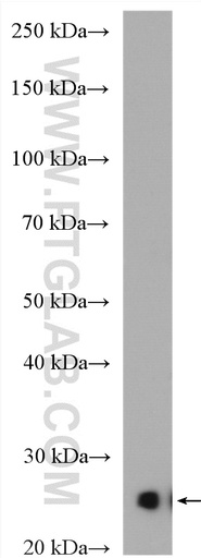 [13170-1-AP-150UL] CIDEA Polyclonal antibody