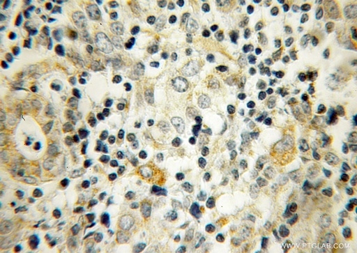 [13172-1-AP-20UL] UBTD2 Polyclonal antibody