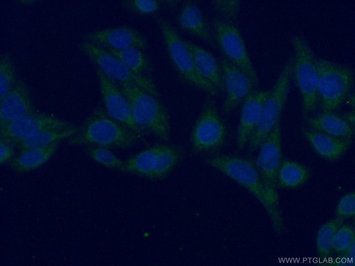 [13177-1-AP-20UL] APBB2 Polyclonal antibody