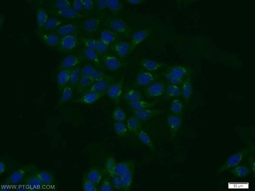 [13178-1-AP-150UL] TBX4/5 Polyclonal antibody