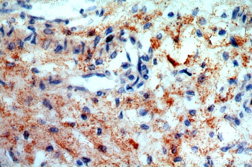 [13180-1-AP-150UL] SNX20 Polyclonal antibody