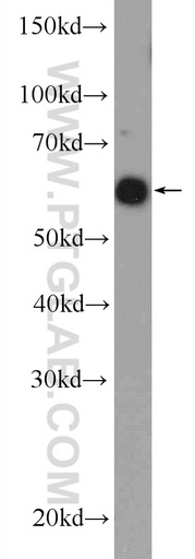 [13181-1-AP-150UL] RBBP5 Polyclonal antibody